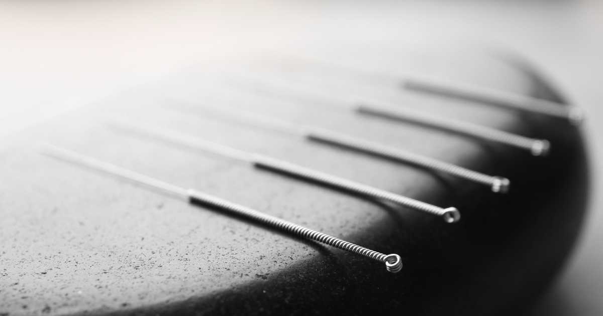 El Prompt del Acupunturista: Cómo desbloquear cualquier proyecto con IA